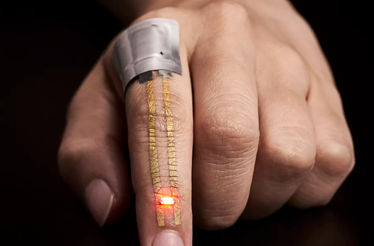 wearable kesehatan