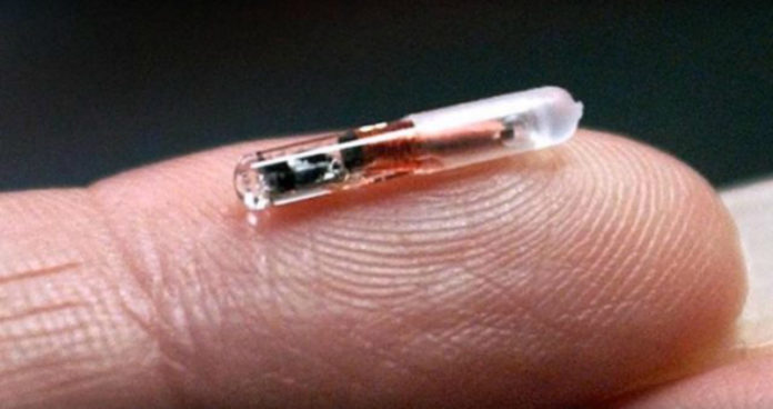 implan chip