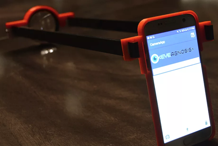 Lensa dan Aplikasi Pendeteksi Penyakit Mata