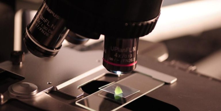 IBM Pakai Machine Learning untuk Deteksi Alzheimer