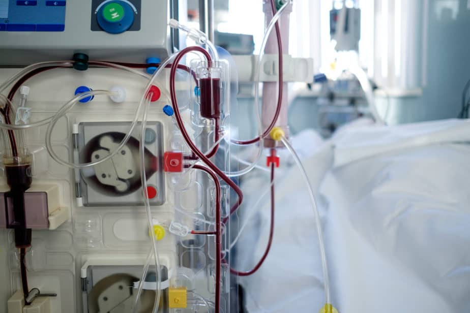 intensive care emergency room with hemodialysis machine (or hemofiltration procedure), patient in critical stance Ginjal akut
