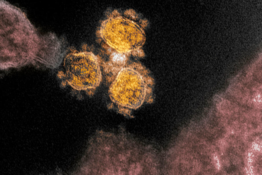 Infeksi virus Corona