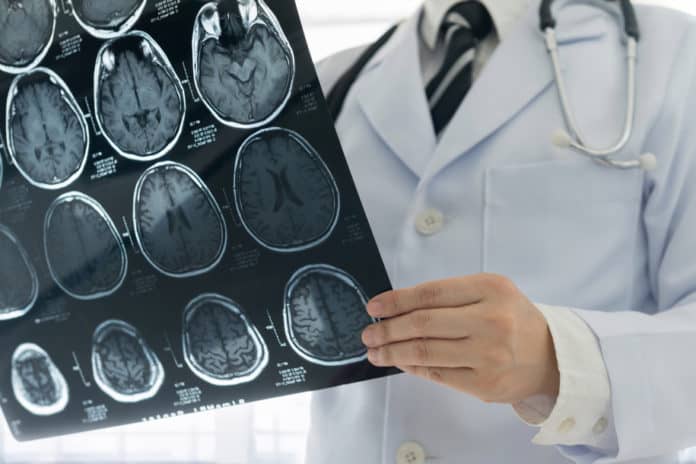 Penderita stroke sembuh