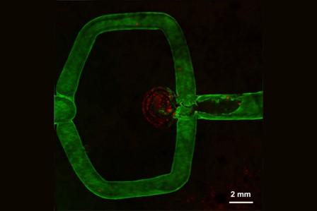 bioprinting-aneurysm-5