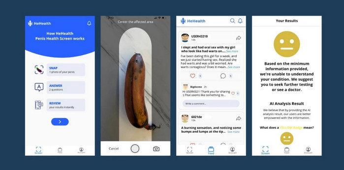 Aplikasi AI HeHealth foto penis