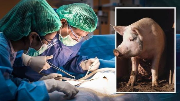 Tim Bedah di China Berhasil Tranplantasi Ginjal Babi ke Manusia